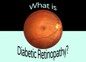 A graphic promoting a blog post about diabetes and vision loss. The graphic is split into two halves. The top half has a black background with mint green text reading "What is." The bottom half has a pale mint background with large black text reading "Diabetic Retinopathy?" In the centre, a detailed clinical retinal scan photograph shows the inside of a human eye, with visible blood vessels spreading across the orange-toned surface of the retina.